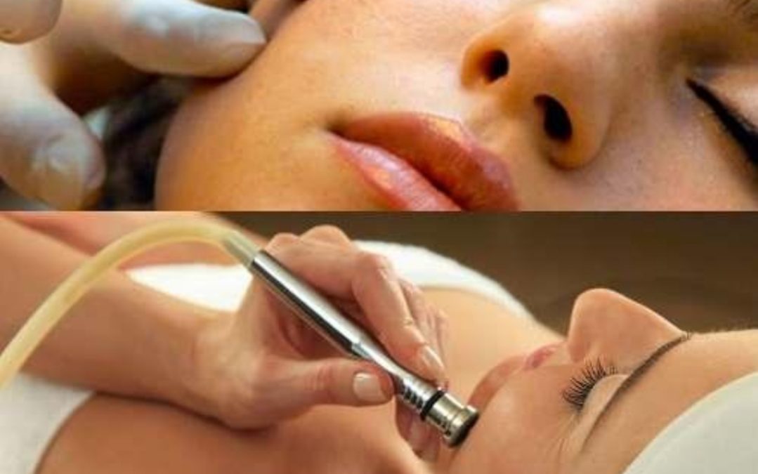 Oferta octubre tratamiento facial con punta de diamante Reus